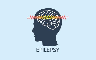 Epilepsiya zamanı ilkin yardım